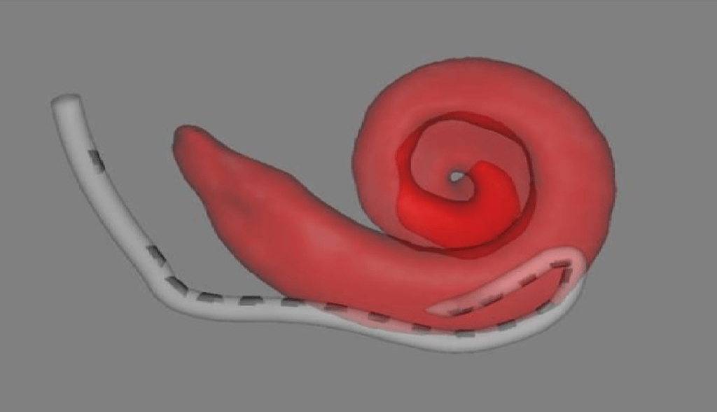 Matt’s Story (Part&nbsp;1)