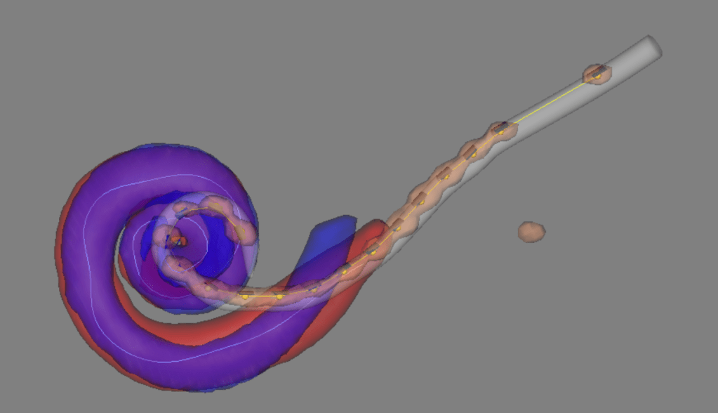 Matt’s Story (Part&nbsp;2)